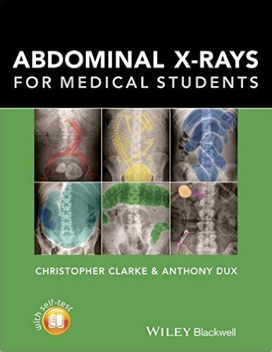 download Abdominal X-rays for Medical Students